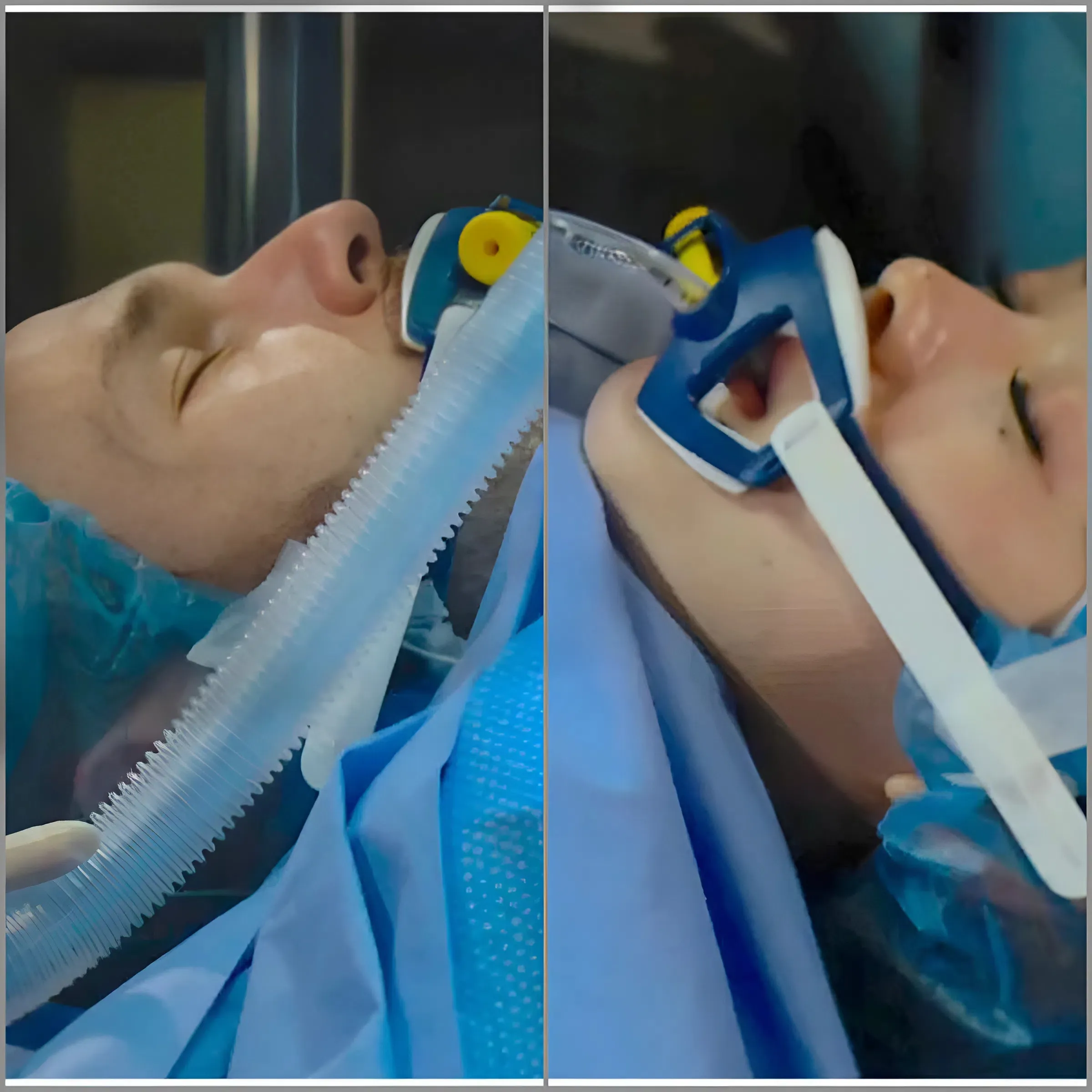 Oops! Bold & Beautiful Star Inadvertently Reveals the Outcome of Liam and Luna’s Life-or-Death Surgeries