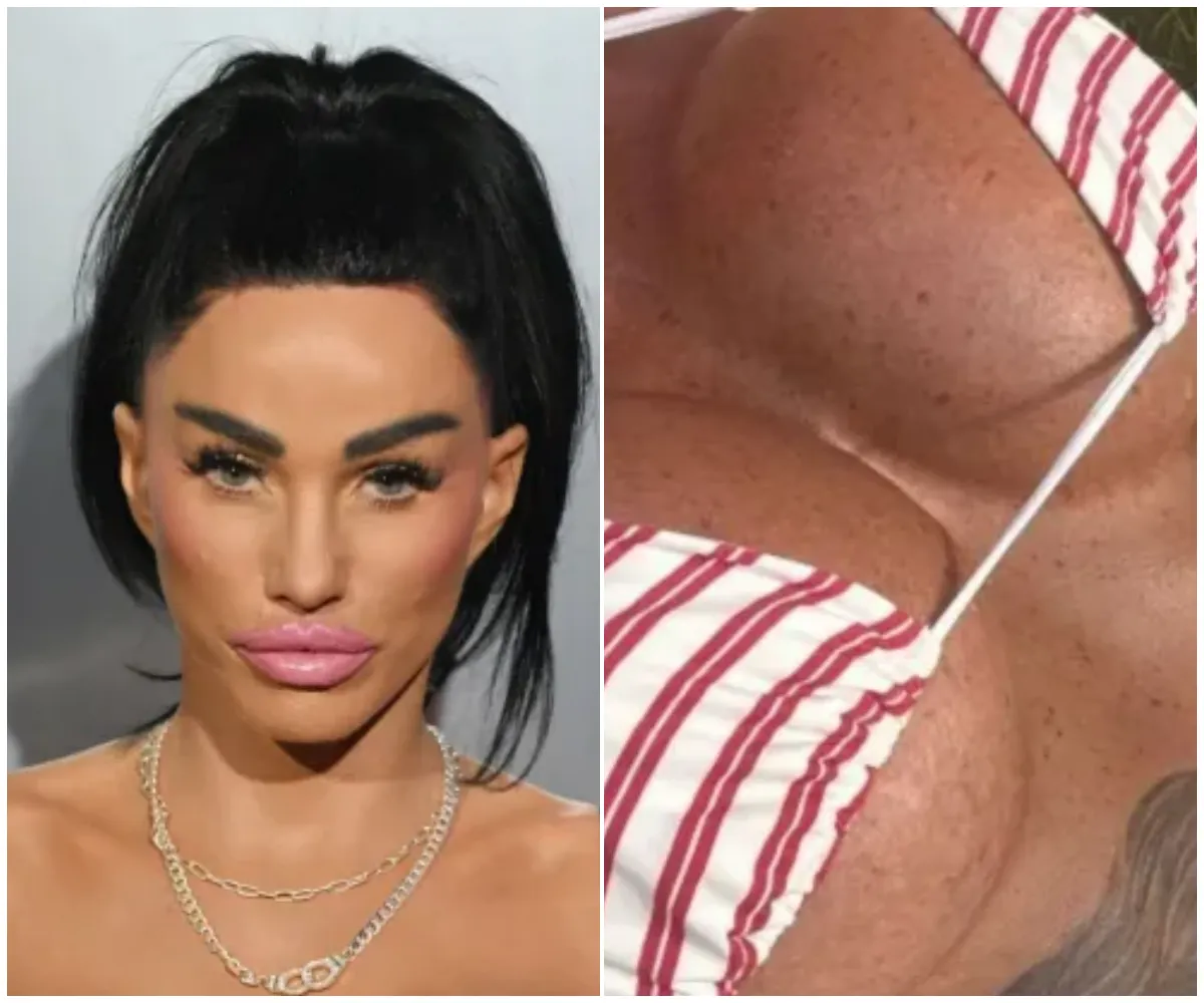 “It’s done so much for my confidence” – Katie Price bares scars from her 17th boob job in revealing bikini snap as fans spot chilling reminders of botched BBL and tight-faced aftermath of her £10k facelift - suong