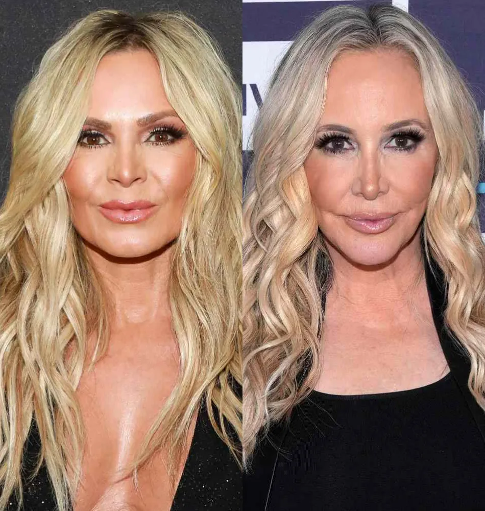 Tamra Judge Says Shannon Has Overstayed Her Welcome on RHOC, Slams Her for Dissing Eddie & Shares Regret, Plus Shades Gretchen & Jen, & Offers Update on Teddi