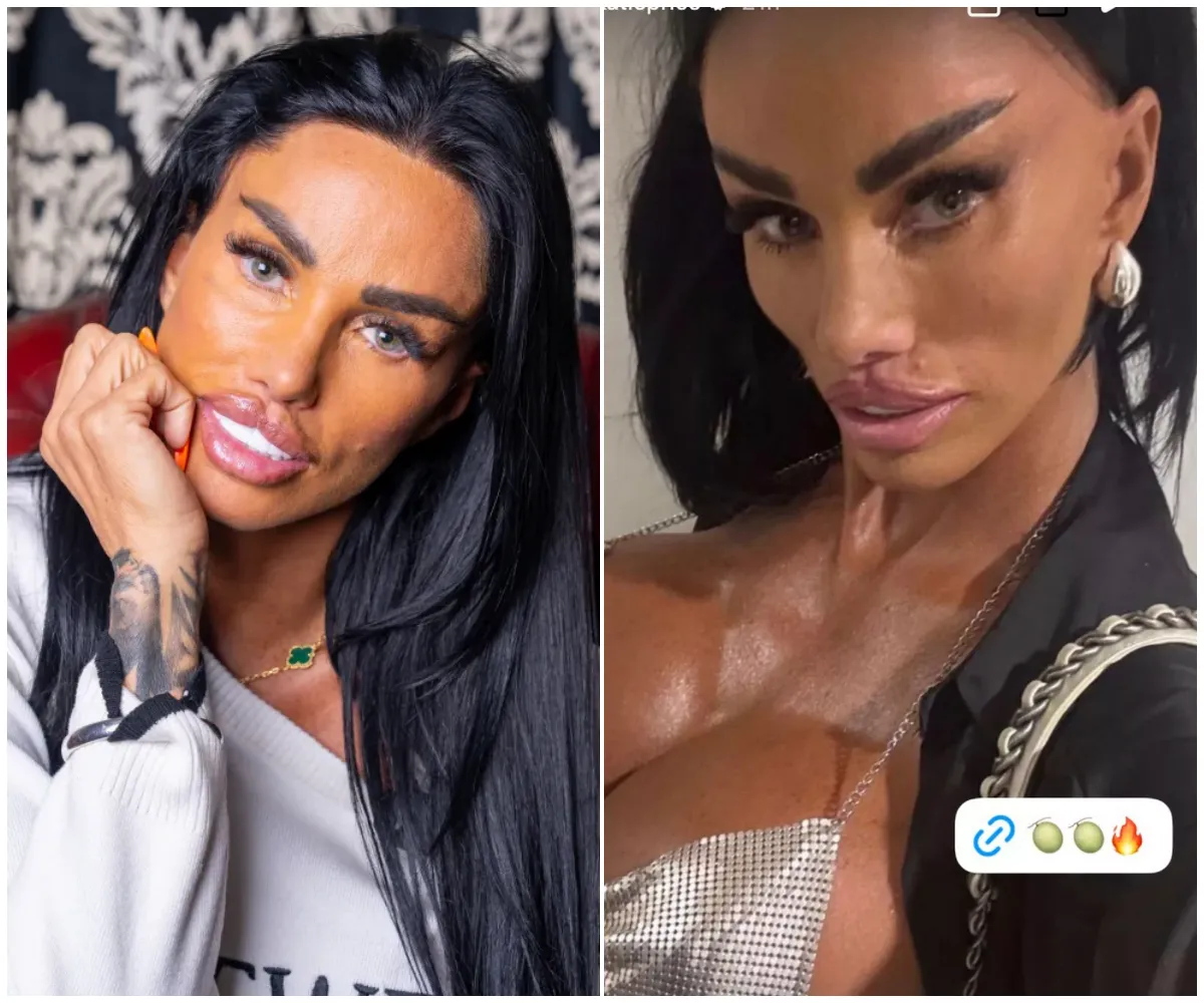 “I can finally relax – the needle’s done” – Katie Price’s face looks more stretched than ever as she shares painful selfie in skimpy silver top following £10,000 facelift and botched BBL nightmare abroad - suong