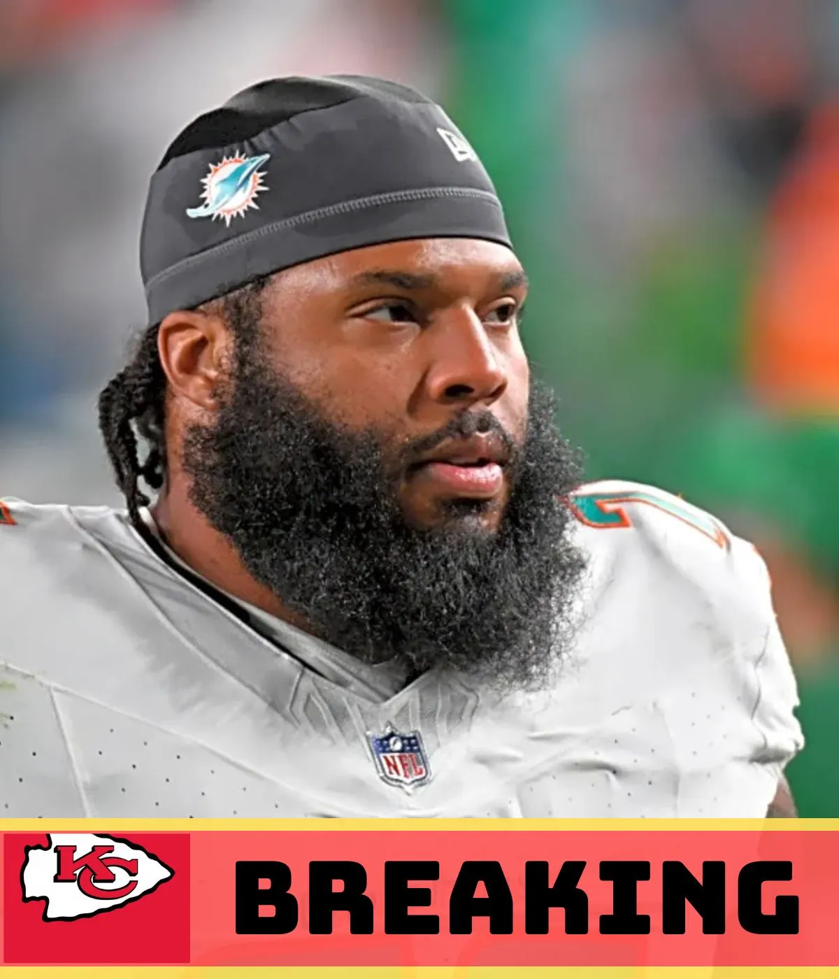 Kansas City Chiefs can kick the tires on ceiling-raising free agents with signings or tryouts at 2025 NFL training camp