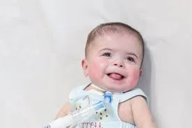 Baby born weighing 1 pound expected to go home after spending over 400 days at hospital