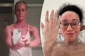 The scary condition sufferers say ‘traps you in your own half-alive corpse’ — it’s caused by a medication taken by millions