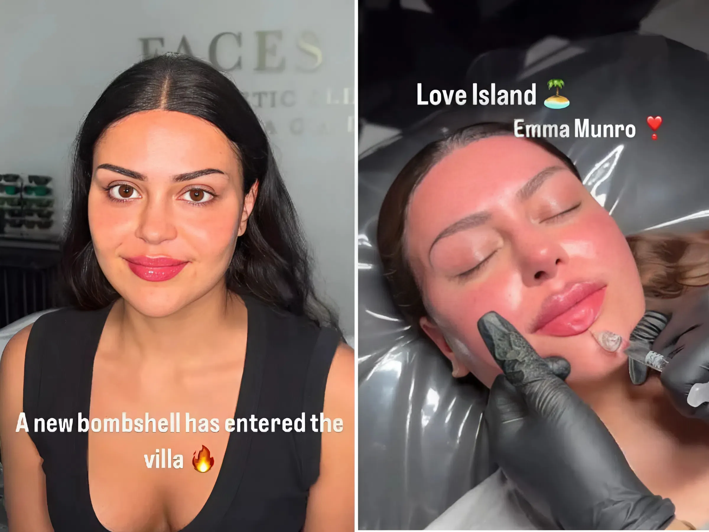 "I upgraded myself — now he has to face it!" – Emma Munro declares as she reunites with her ex on Love Island.