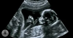 PP1.  Scientists May Have Actually Found One Of The Causes Of Autism