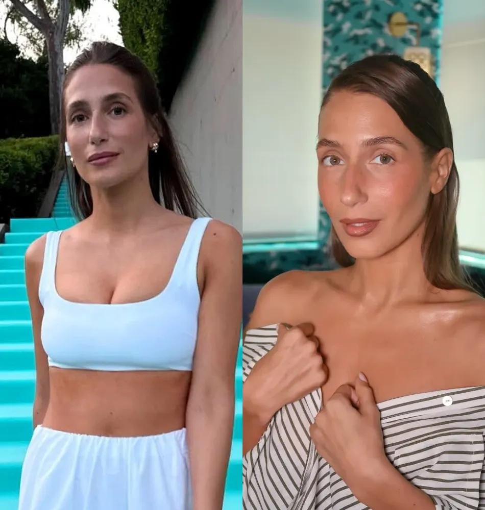 Amanda Batula Reveals ‘Summer House’ Salary Details, Why She Didn’t Get a Prenupp