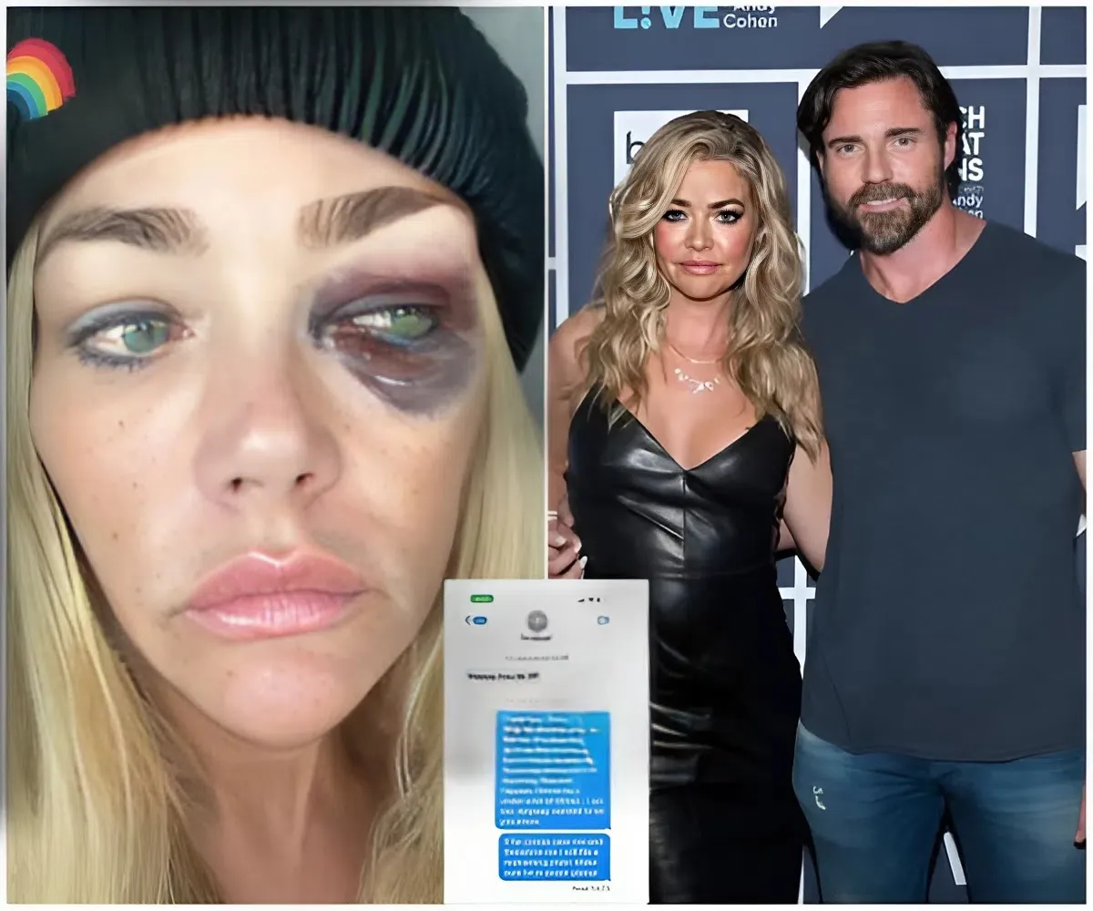 Denise Richards accuses Aaron Phypers of brutal abuse, violent threats and hacking her private messages as shocking photos of injuries emerge and restraining order is granted amid chilling claims of choking, stalking and promises to ...