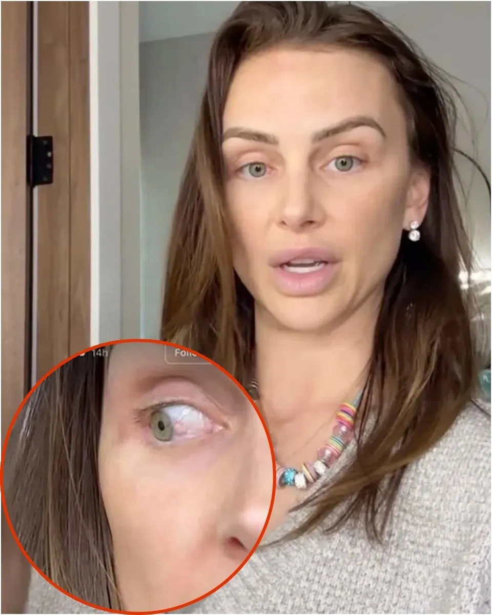 Lala Kent Shares the Latest on Her Pre-Cancer Eye Abnormality & Chemotherapy Treatment