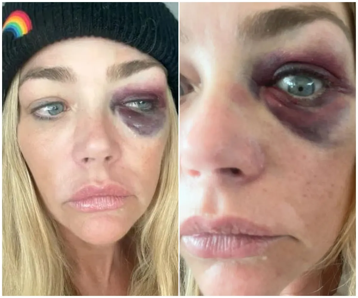 Denise Richards accuses Aaron Phypers of violent assaults, chilling death threats and secret hacking in explosive court documents that detail years of alleged abuse behind their reality TV marriage façade - suong