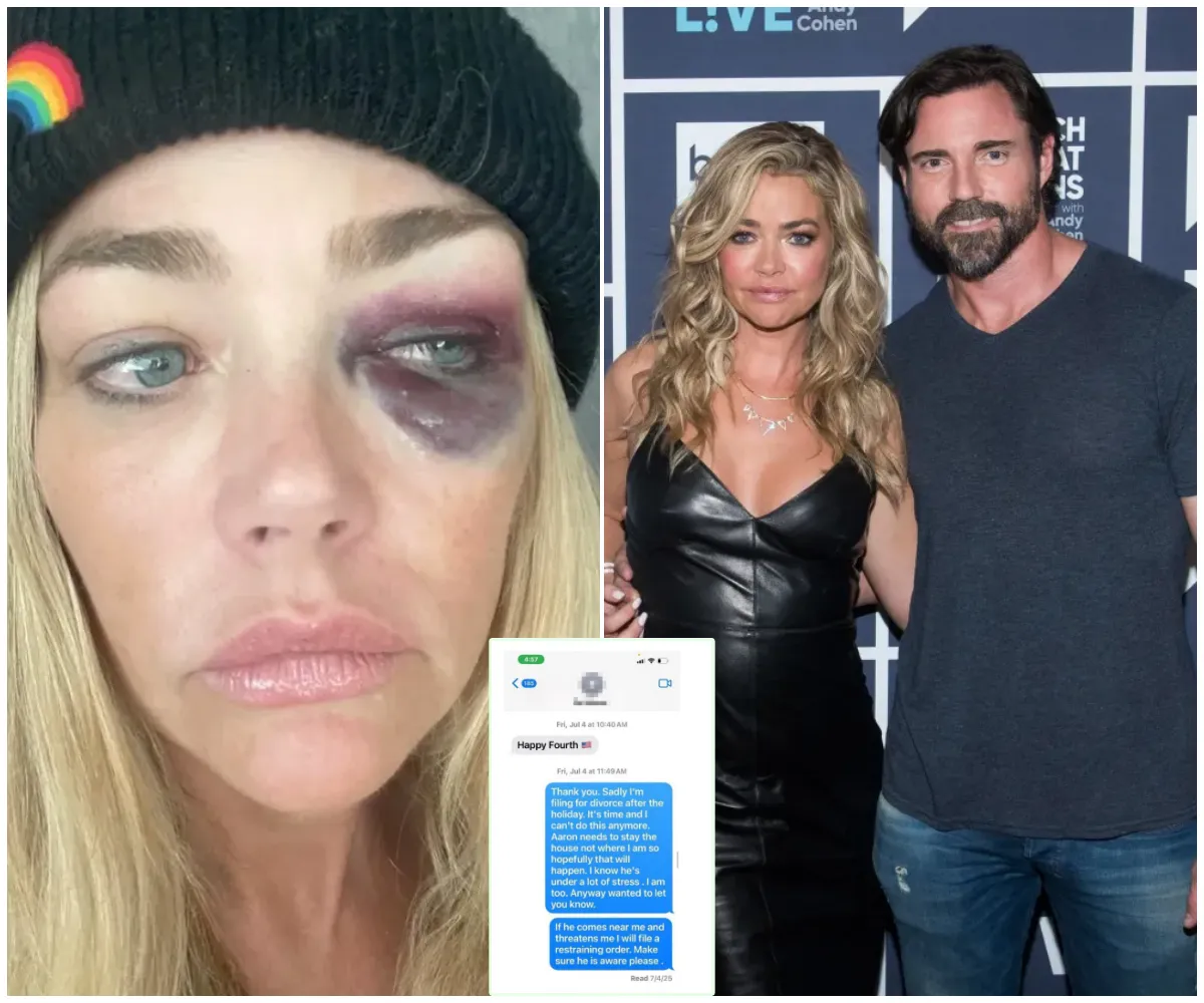 Denise Richards accuses Aaron Phypers of brutal abuse, violent threats and hacking her private messages as shocking photos of injuries emerge and restraining order is granted amid chilling claims of choking, stalking and promises to ...- suong