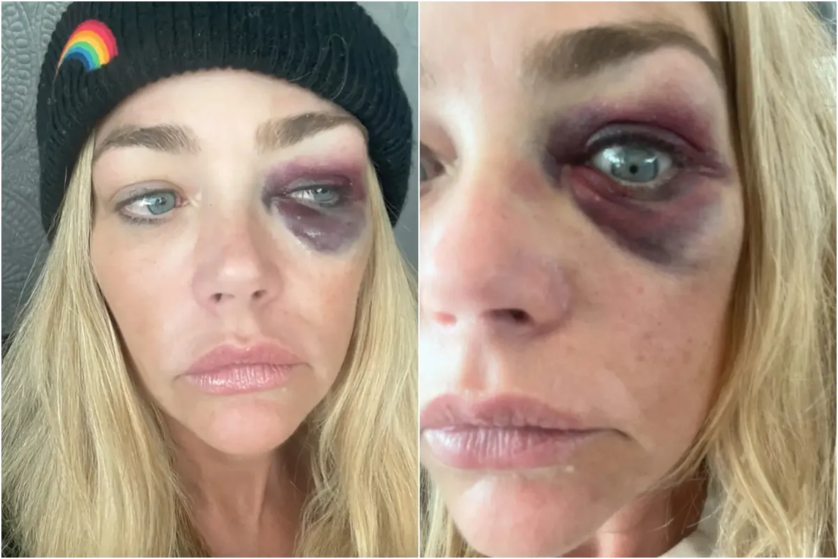 Denise Richards Accuses Estranged Husband Aaron Phypers of Domestic Violence, Granted Temporary Restraining Order