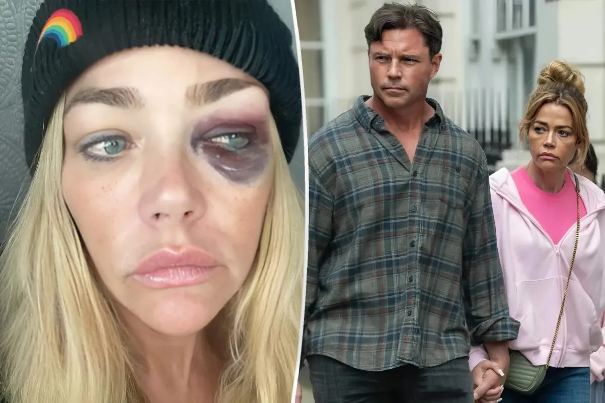 Denise Richards Accuses Estranged Husband Aaron Phypers of Attempted Murder in Shocking Abuse Revelations - lulu