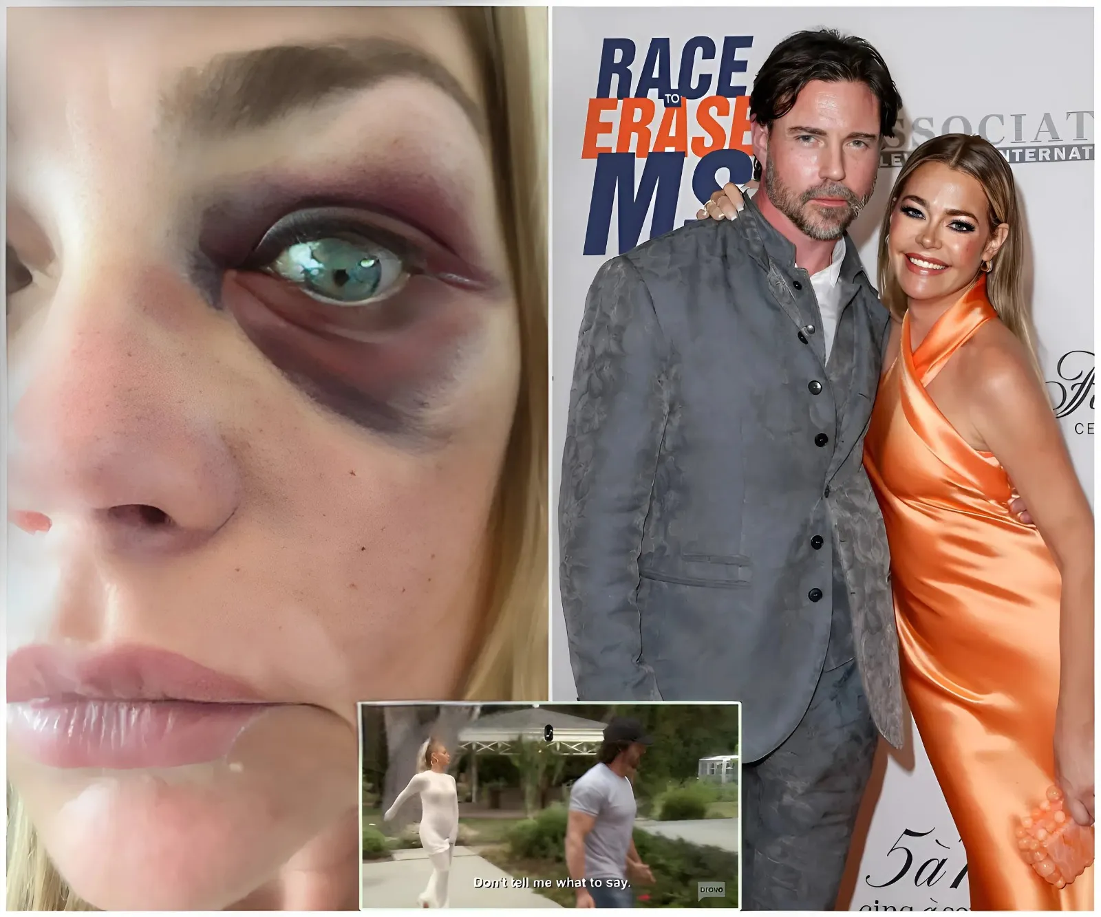 “I’m going to crush your f—king hand” – Chilling moment Aaron Phypers threatens Denise Richards in resurfaced RHOBH clip as abuse allegations explode and Bravo fans question what really happened behind closed doors