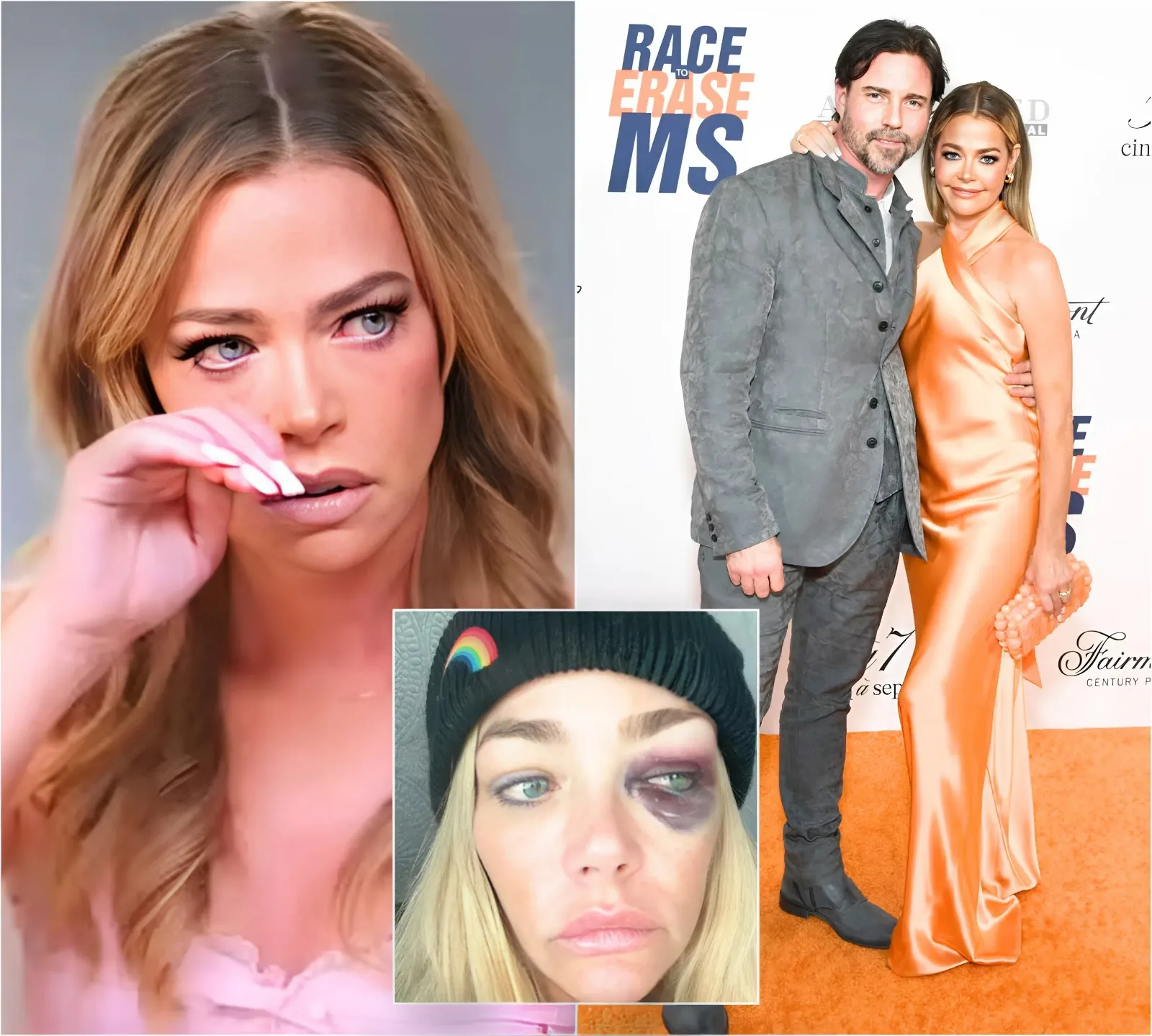 Denise Richards Accuses Aaron Phypers of Horrifying Abuse and Threatening to Kill Her as RHOBH Alum Shares Pics of Her Injuries & is Granted Restraining Order
