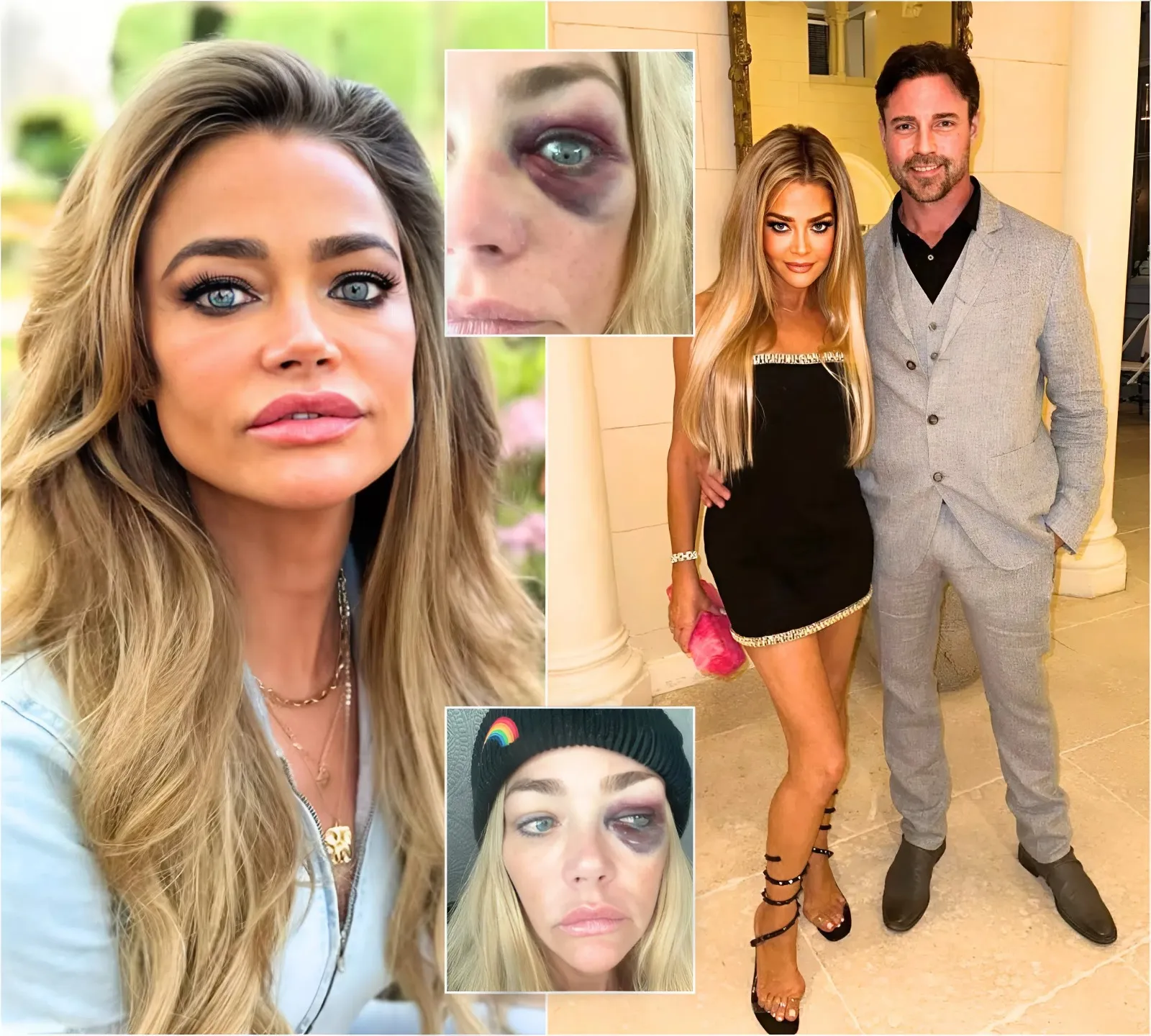 “He Said He’d Kill Me If I Ever Left”: RHOBH’s Denise Richards Accuses Aaron Phypers of Years of Vicious Abuse, Death Threats, and Control as She Shares Disturbing Injury Photos and Is Granted Emergency Restraining Order