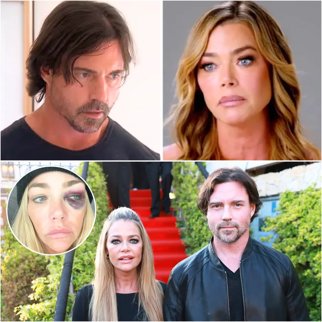 Denise Richards' estranged husband Aaron Phypers denies 'harmful and baseless' abuse allegations