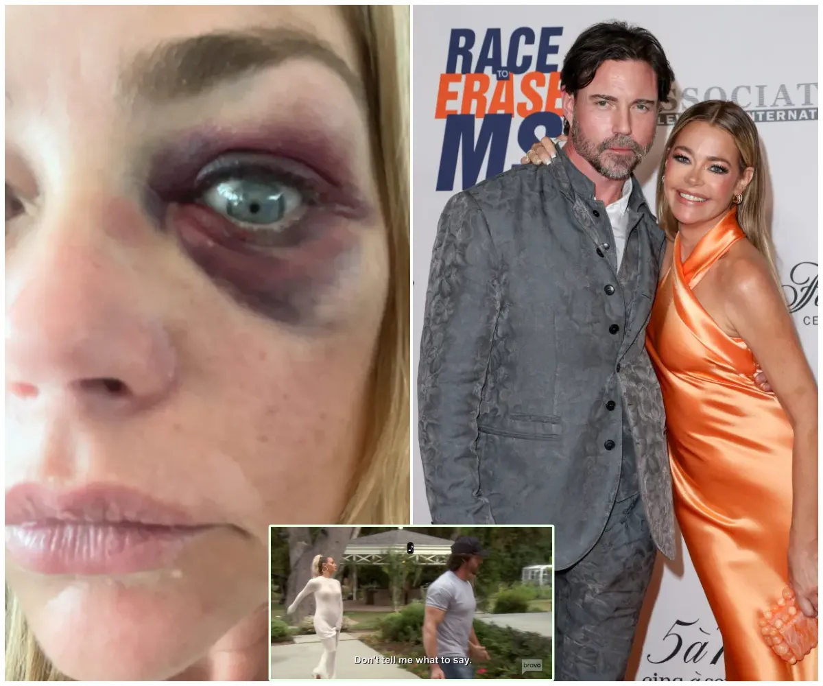 “I’m going to crush your f—king hand” – Chilling moment Aaron Phypers threatens Denise Richards in resurfaced RHOBH clip as abuse allegations explode and Bravo fans question what really happened behind closed doors - suong