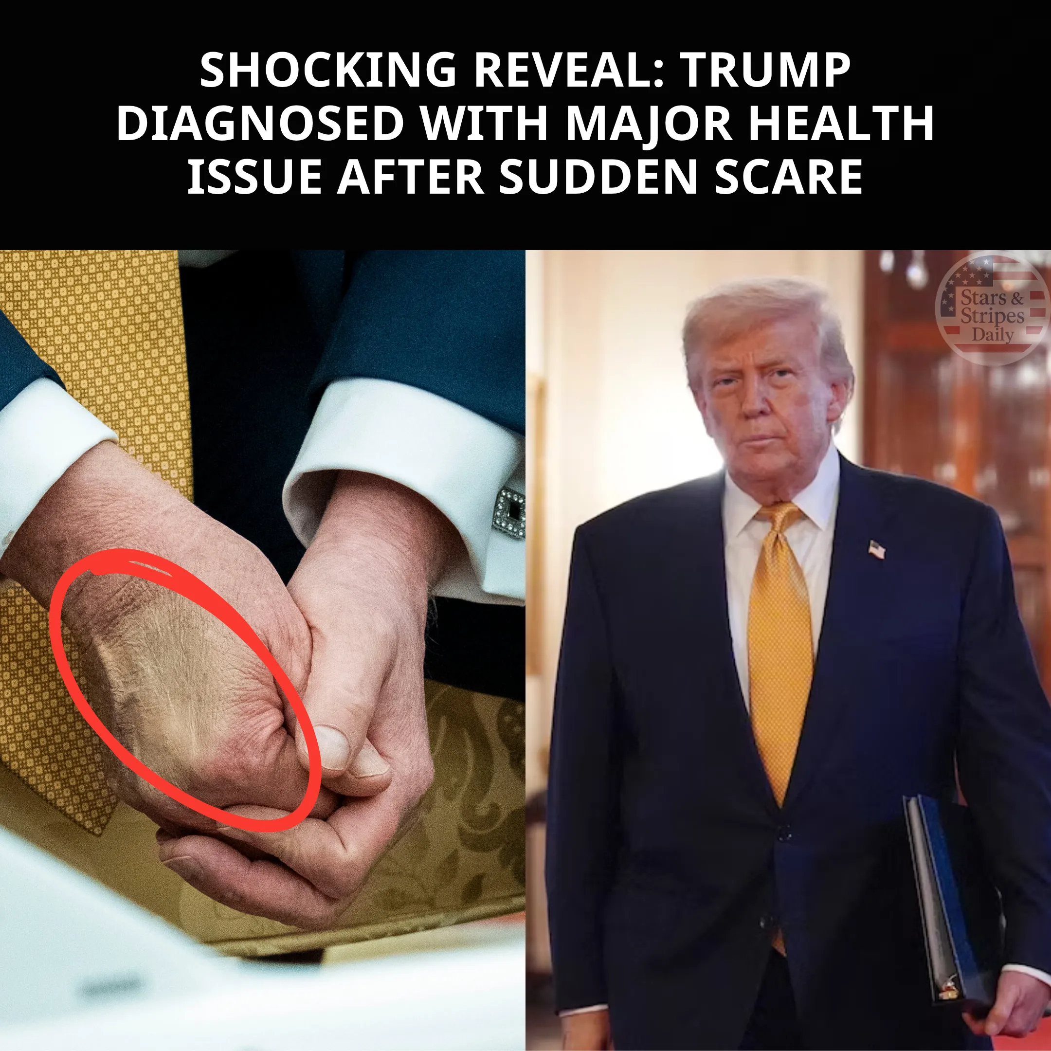 Shocking reveal: Trump diagnosed with major health issue after sudden scare