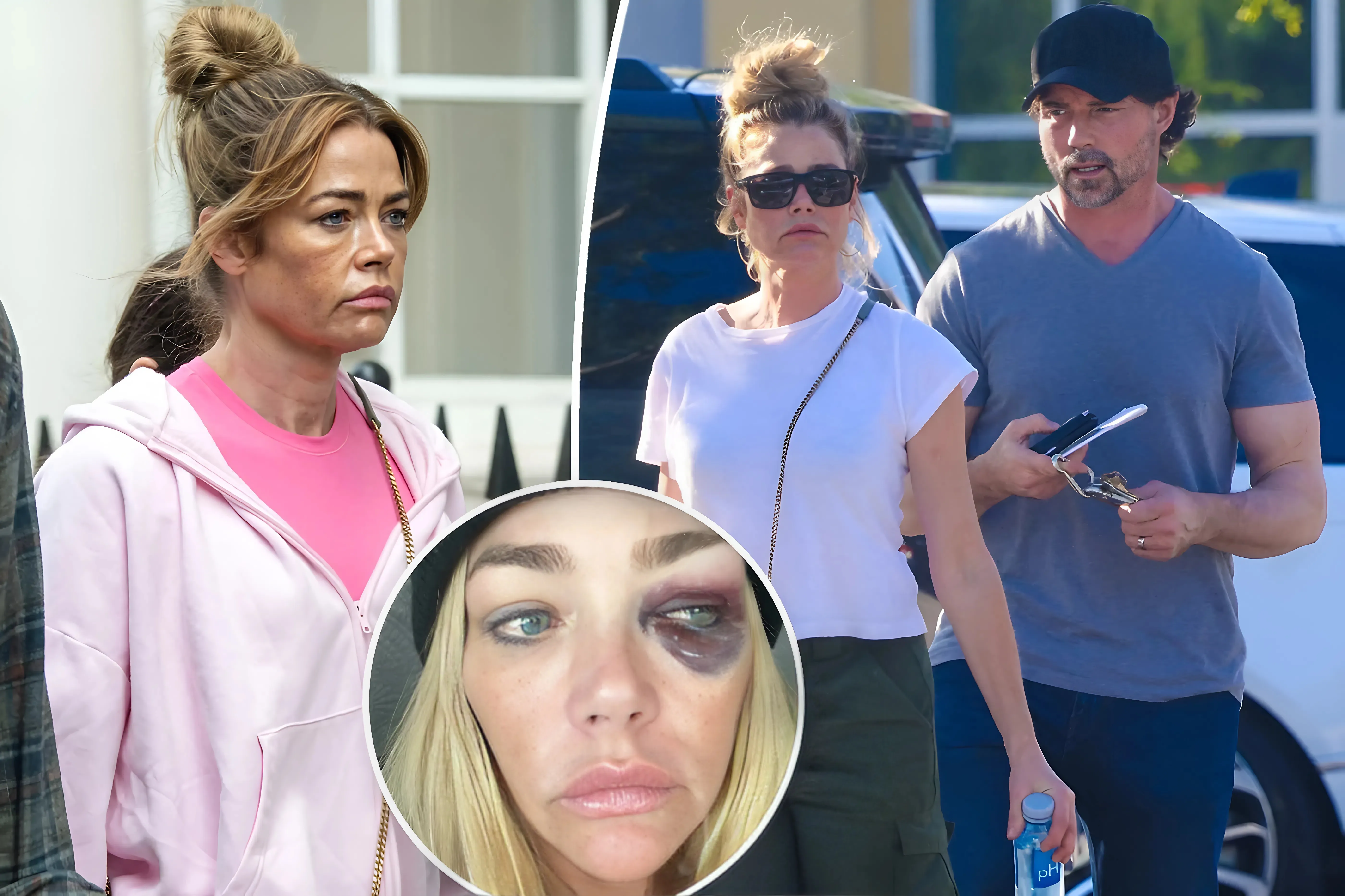 Denise Richards reveals the ‘degrading profanities’ Aaron Phypers said as he ‘repeatedly’ hit her in explosive final fight
