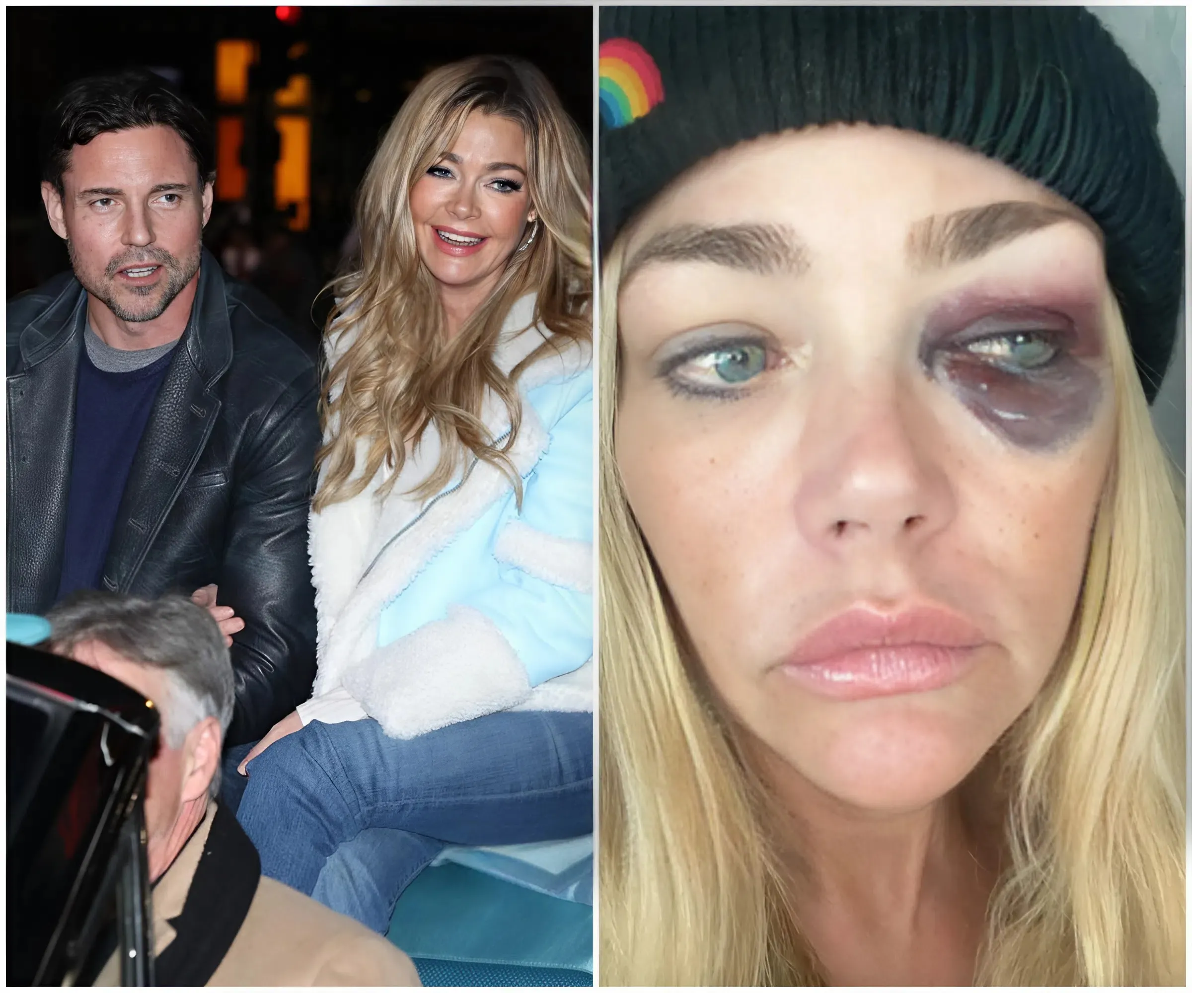 "SHOCKING RHOBH Drama: Aaron Phypers Faces $340K Fine For Abusing Denise Richards, Bruises Diagnosed By Doctor As Shocking!"