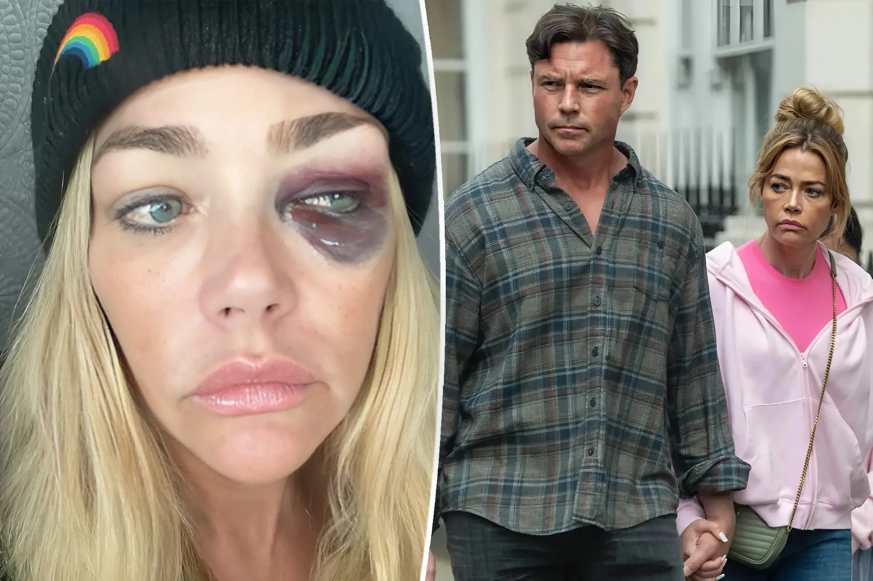 ‘RHOBH’ cast expressed concern for Denise Richards after Aaron Phypers’ on-camera threat