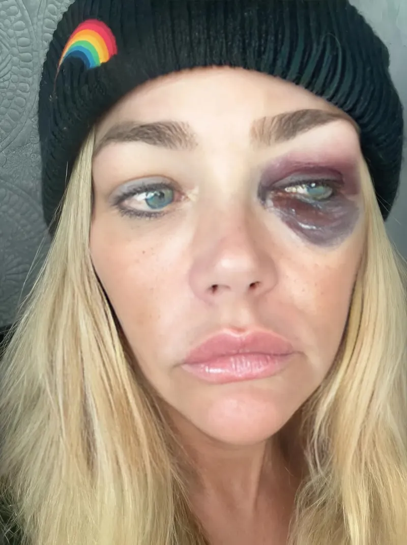 #BreakingNews Pray for Denise Richards 💔🙏