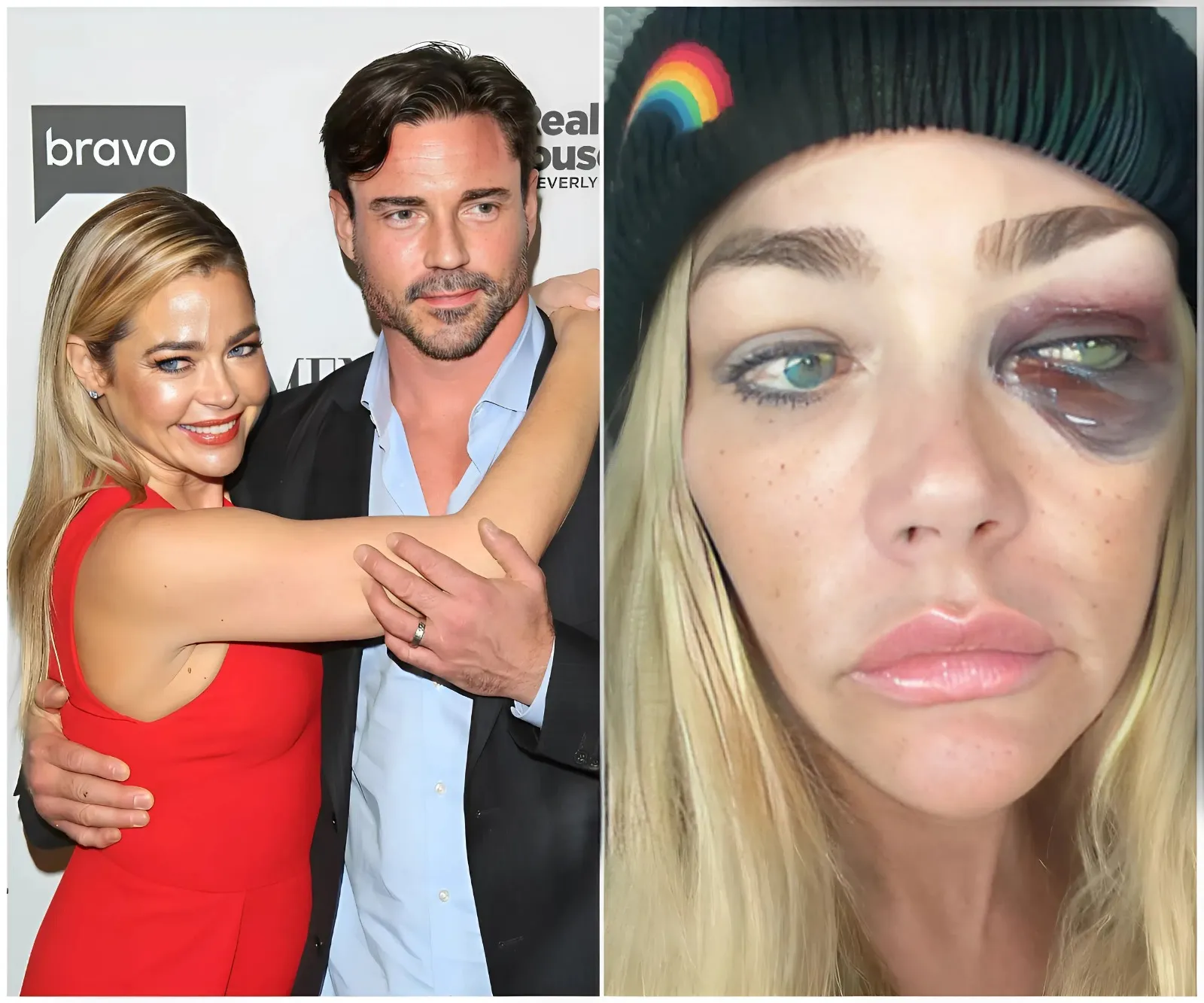 She Makes $250,000 a Month, But Doesn't Help Me a Single Dimehttps://pagesix.com/wp-content/uploads/sites/3/2025/07/denise-richards-camille-grammer-seemingly-8849119.jpg