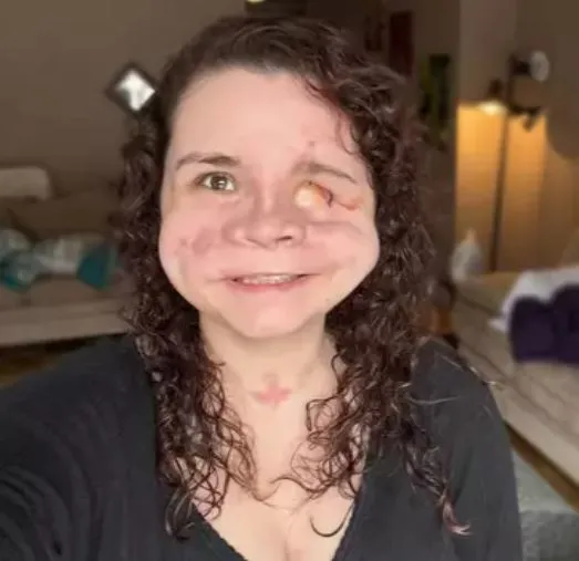 Woman given ‘less than 2%’ chance of survival after being shot in the face shares important message about horrific trauma Woman given ‘less than 2%’ chance of survival after being shot in the face shares important message about horrific trauma