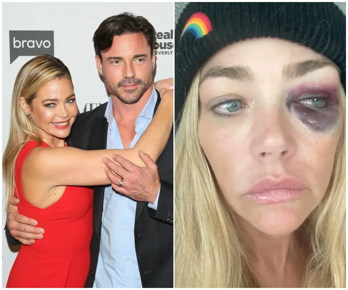 Denise Richards’ ex Aaron Phypers accuses her of cheating with secret hotel meet-ups just days after she alleged he threatened to kill her and left her with multiple concussions in explosive domestic violence claims - suong Denise Richards’ ex Aaron Phypers accuses her of cheating with secret hotel meet-ups just days after she alleged he threatened to kill her and left her with multiple concussions in explosive domestic violence claims - suong