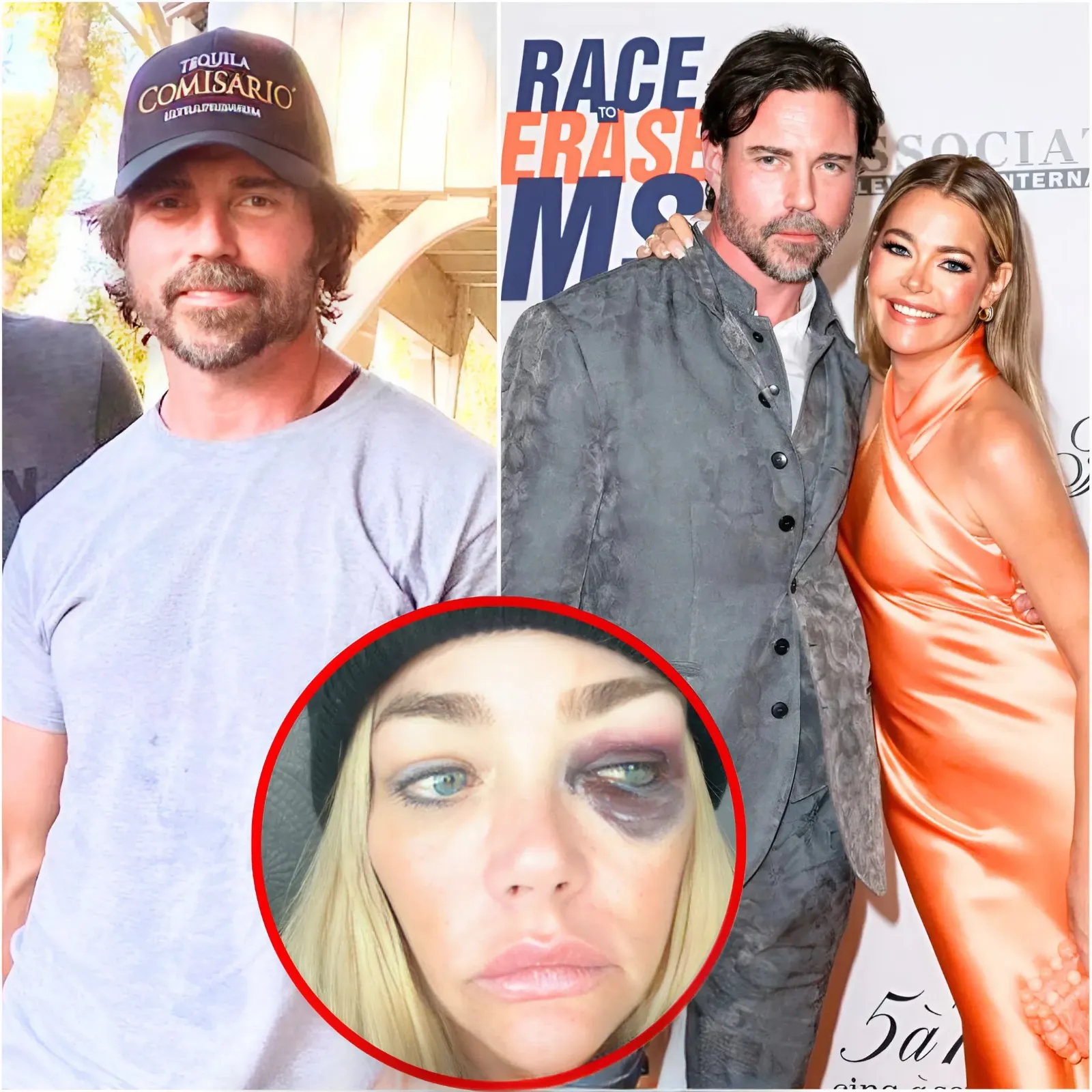 “She Painted Me as a Monster”: Aaron Phypers Accuses Denise Richards of Infidelity After She Drops Bombshell Abuse Claims