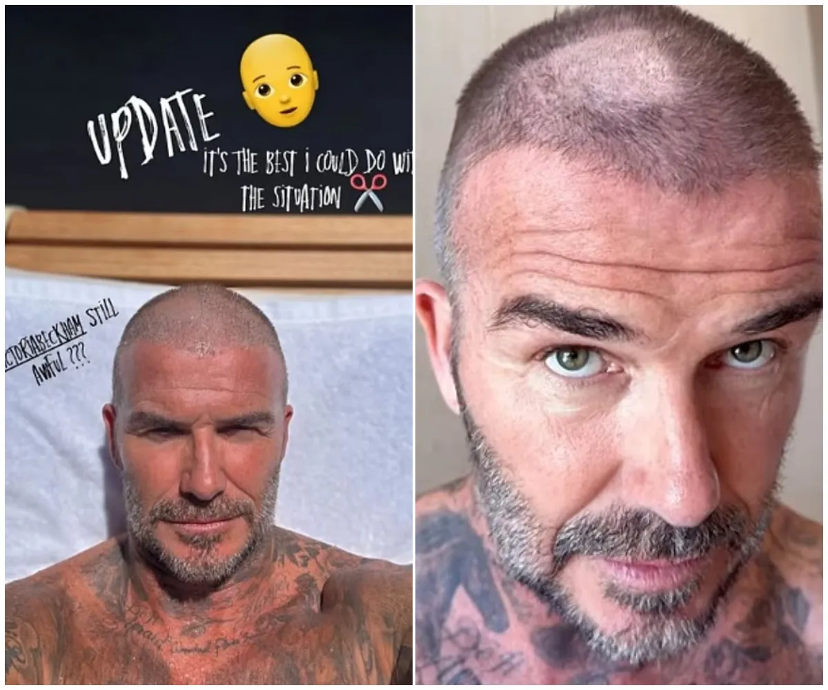 ‘UPDATE… The best I can do with the situation’ — David Beckham stuns fans as he shares the shocking aftermath of his DIY buzz-cut disaster that left him with a glaring bald patch… and reveals how Victoria brutally reacted to his hair blunder - suong