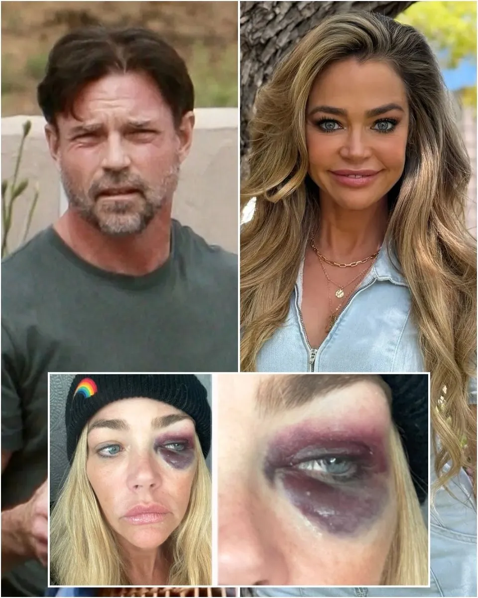Aaron Phypers Sends Letter to Denise Richards’ Family Urging Intervention for Her, Claims RHOBH Alum Neglects Daughter & is Addicted to Vicodin