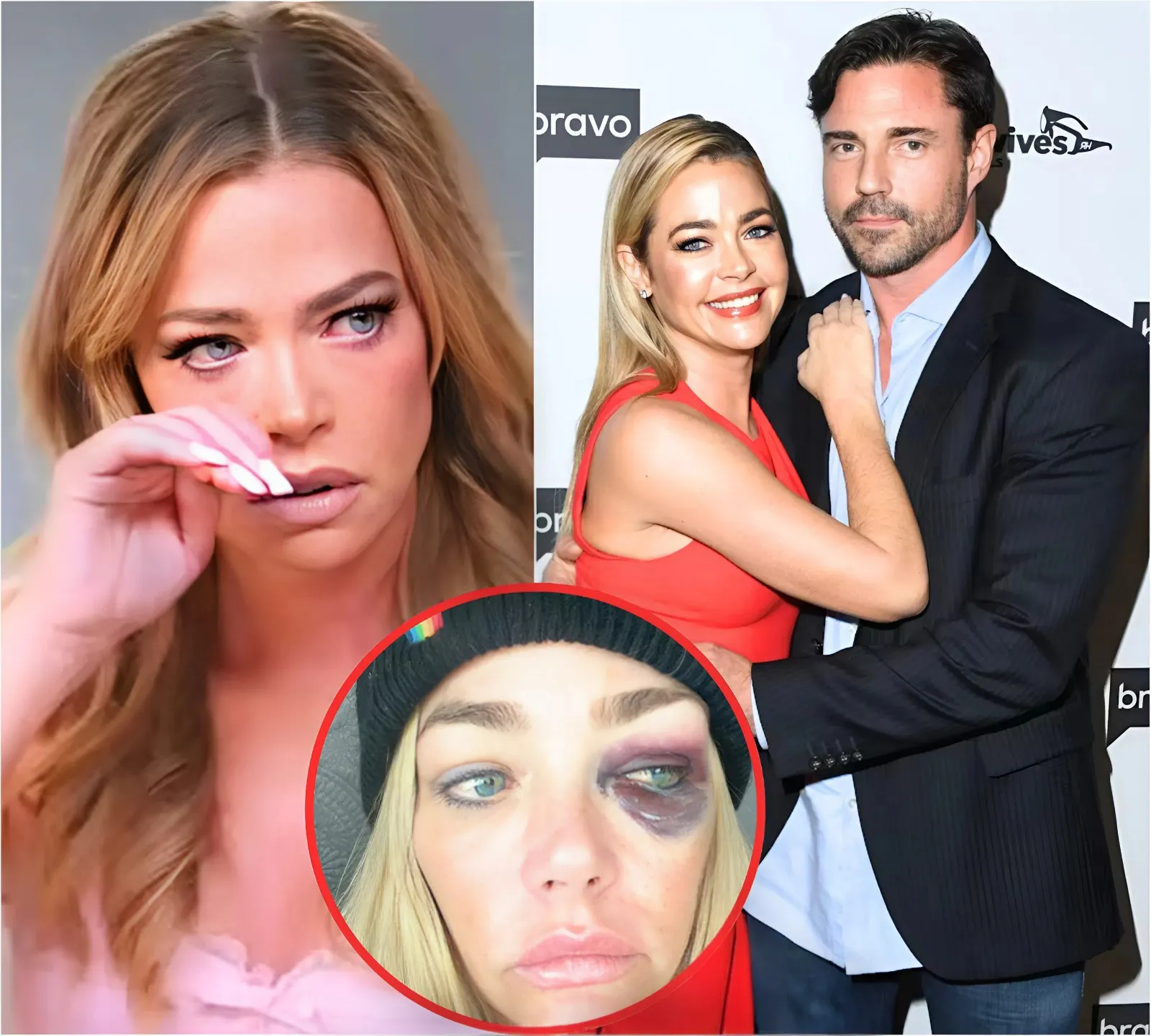 Denise Richards’ Husband Aaron Phypers Files Police Report Against Her as She Accuses Him of Ongoing Harassment and Steps Out Without Wedding Ring