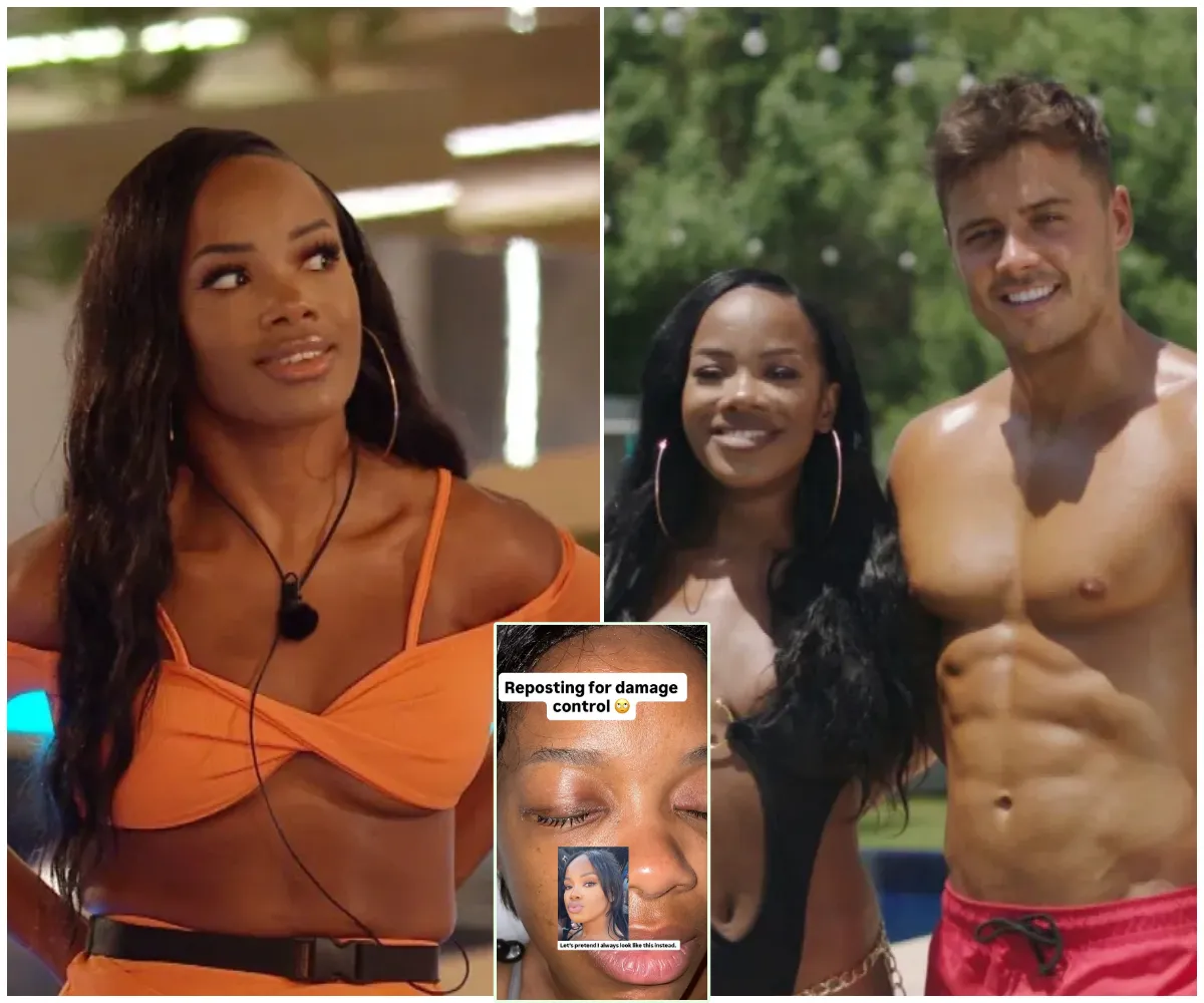 ‘Worst pain in her entire life’ — Love Island star rushed to hospital in sudden health emergency as fans notice shocking social media wipeout and cryptic message about “protecting her peace” - suong