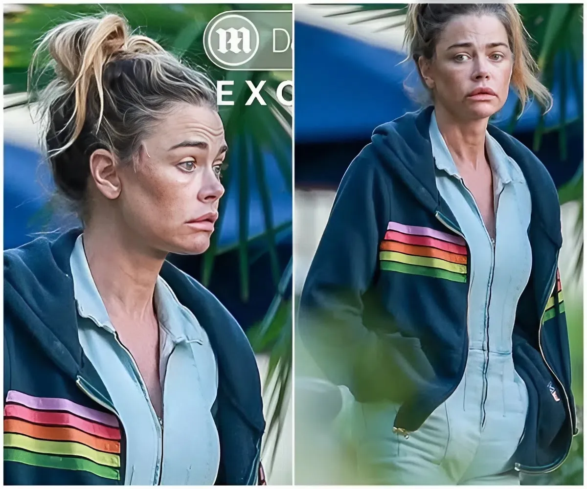 Denise Richards sparks fears over BOTCHED new 'facelift'... amid ugly divorce from Aaron Phypers