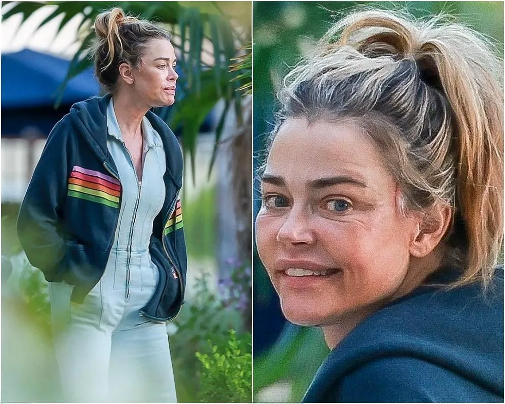Denise Richards sparks fears over BOTCHED new 'facelift'... amid ugly divorce from Aaron Phypers