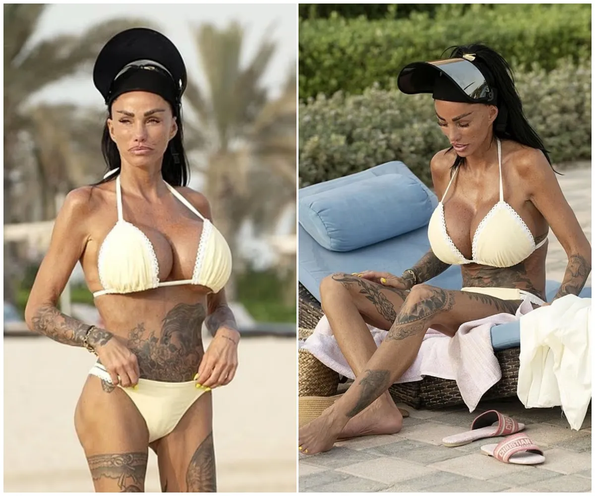 ‘What would I do without it?’ — Katie Price stuns in a barely-there butter yellow bikini and oversized mirrored visor on the beach in Dubai as she reveals the surprising secret helping her cope with painful bum filler treatment - suong