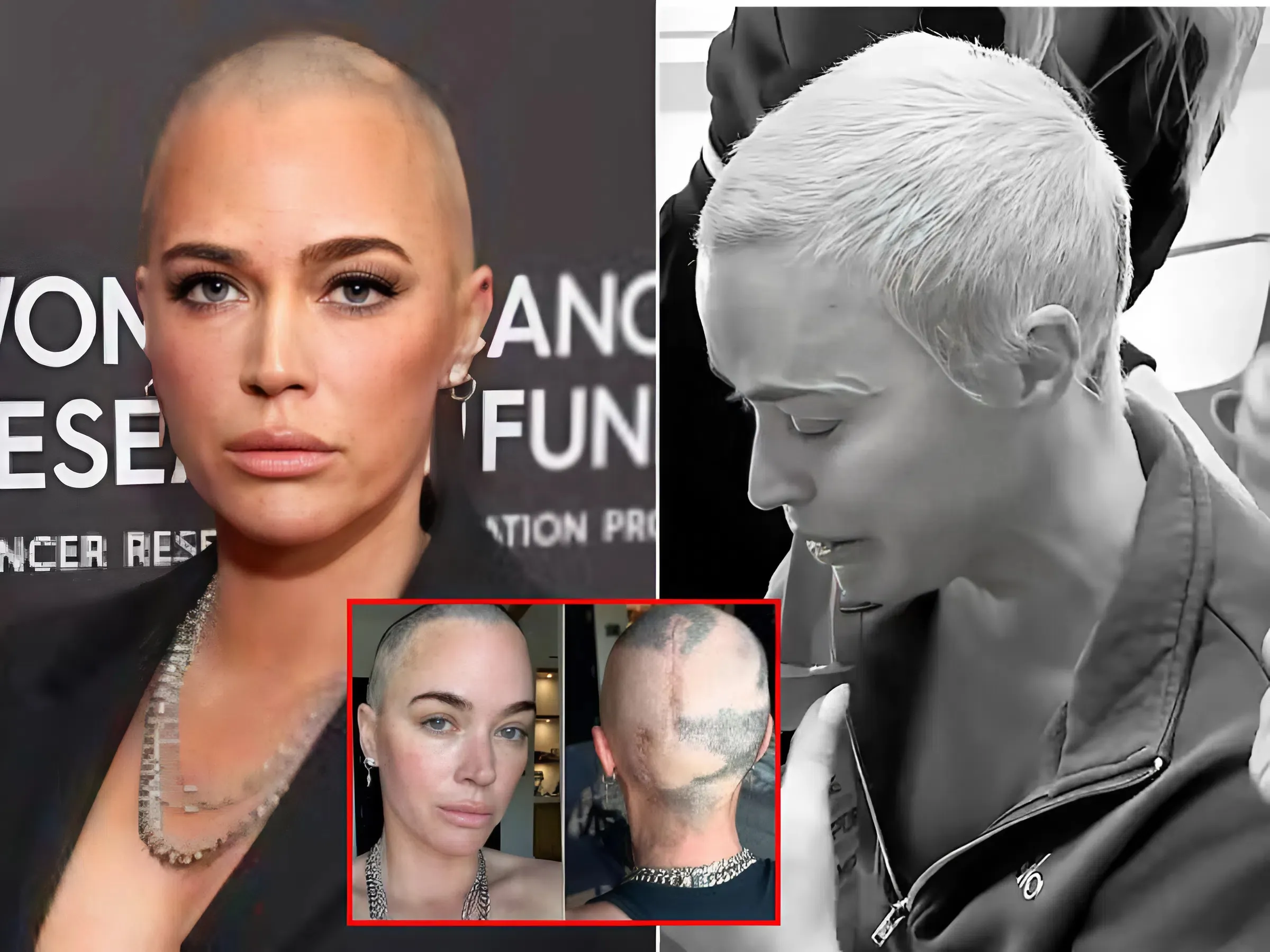 “Stopped Treatment Midway?” – Teddi Mellencamp Breaks Her Silence and Fires Back at Whispers After Controversial Decision
