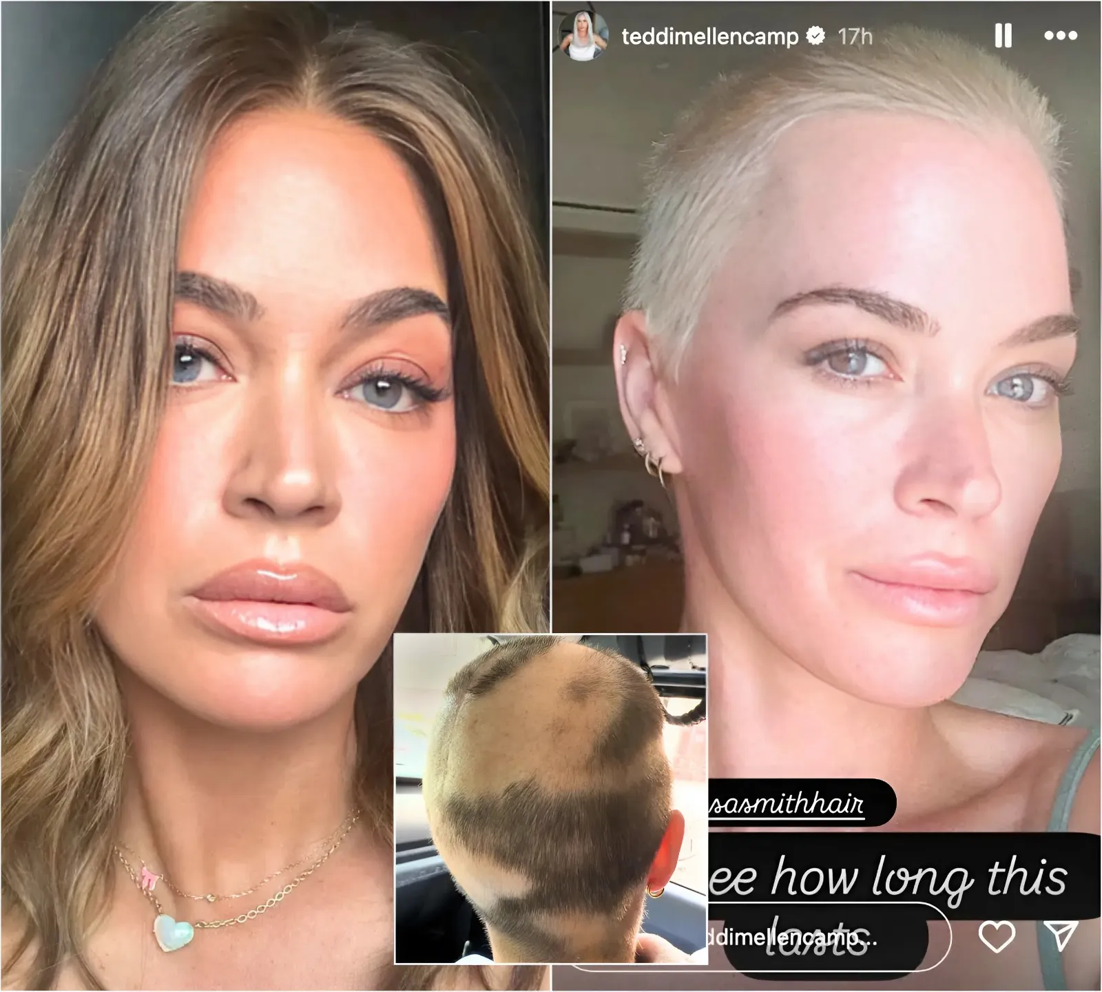 Teddi Mellencamp Unveils Bold Platinum Buzzcut Amid Cancer Battle