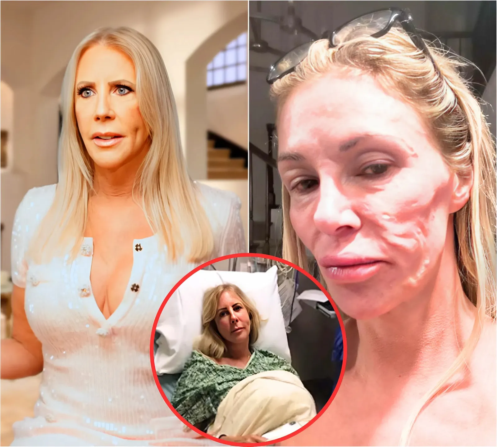 Vicki Gunvalson Says She Contracted The Same Parasite As Brandi Glanville While Filming Ultimate Girls Trip