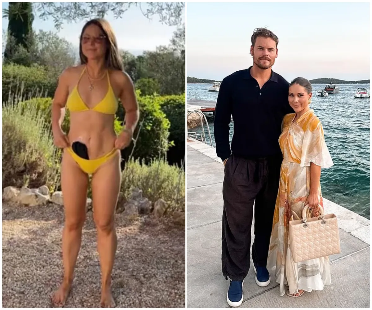 Louise Thompson courageously shows off her stoma bag in a yellow bikini during holiday getaway as she opens up about life after near-death childbirth and delivers powerful message to trolls ‘Be kind’ - suong