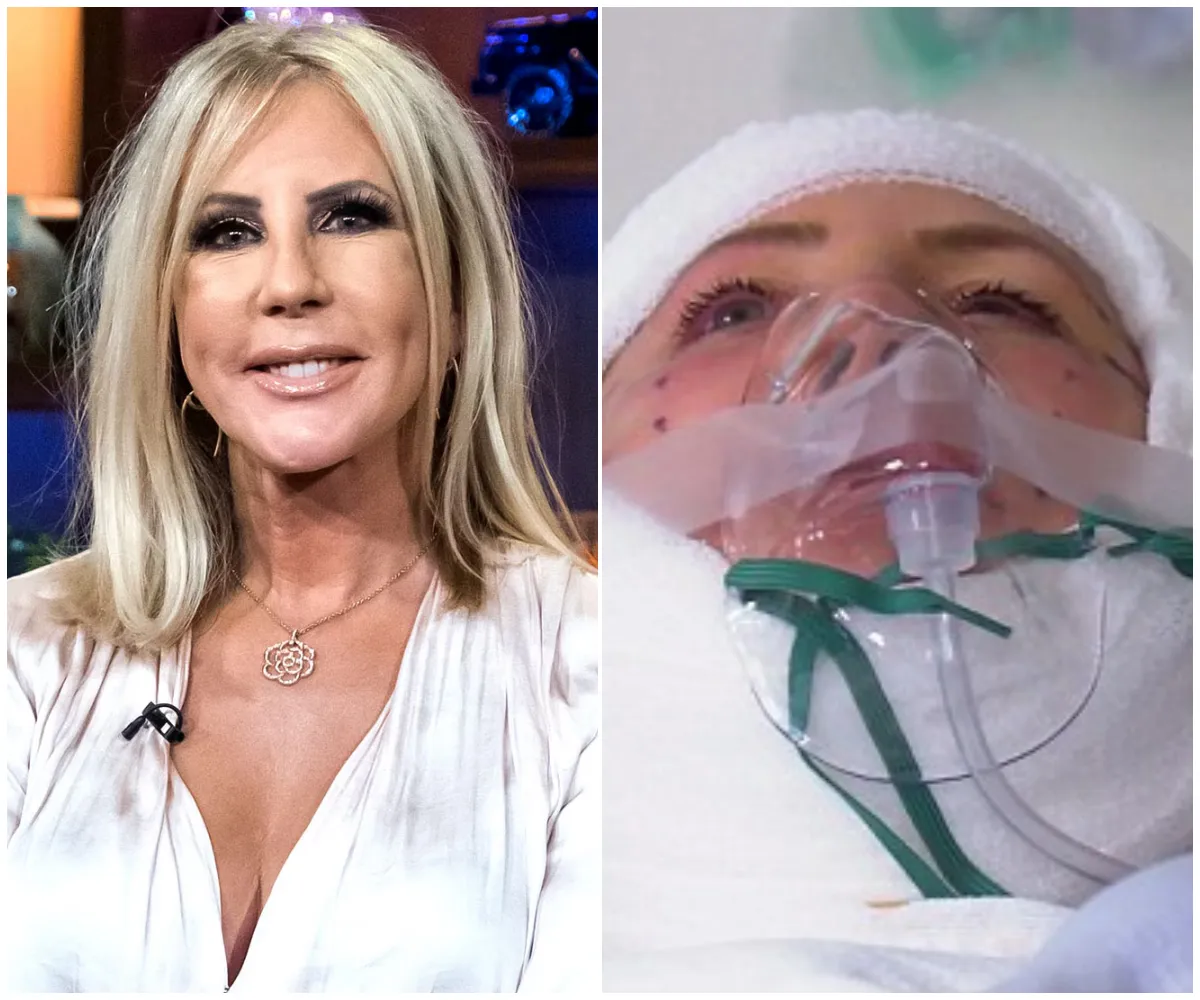 LEAKED CLOSE-UP: Shocking never-before-seen image shows visible swelling and distortion around Vicki Gunvalson’s cheeks and jawline — insiders say “the parasite moved into her face” - suong