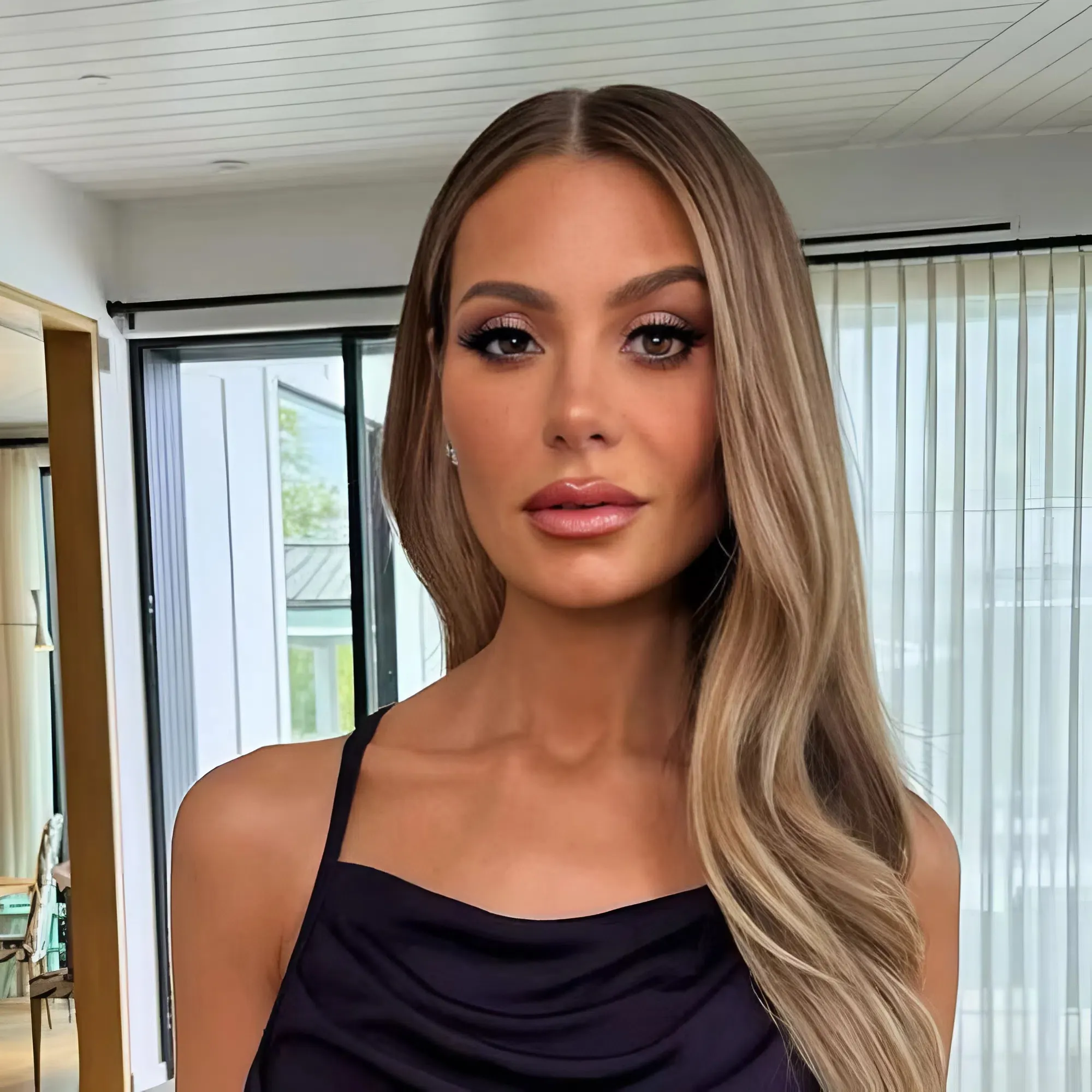 Dorit Kemsley Sues a Nail Salon for $350,000 in Compensation, Reveals Horrifying Images of Ulcerated, Pus-filled Hands and Feet Due to Dirty Tools Causing Infectious Infections, Shocking the Online Community!