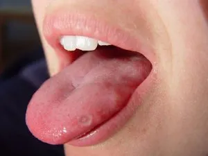 PP2. These are the consequences of eating cr...