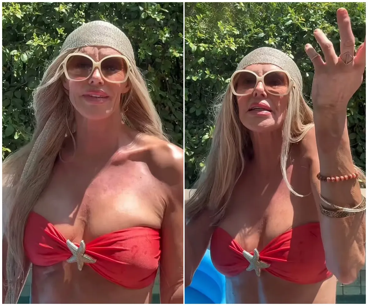 Brandi Glanville teases hot make out session with a 'boy or girl' in wild update on her facial disfigurement - suong