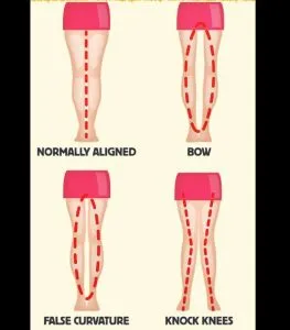 PP2. The separation between a woman's legs means that she is… See more