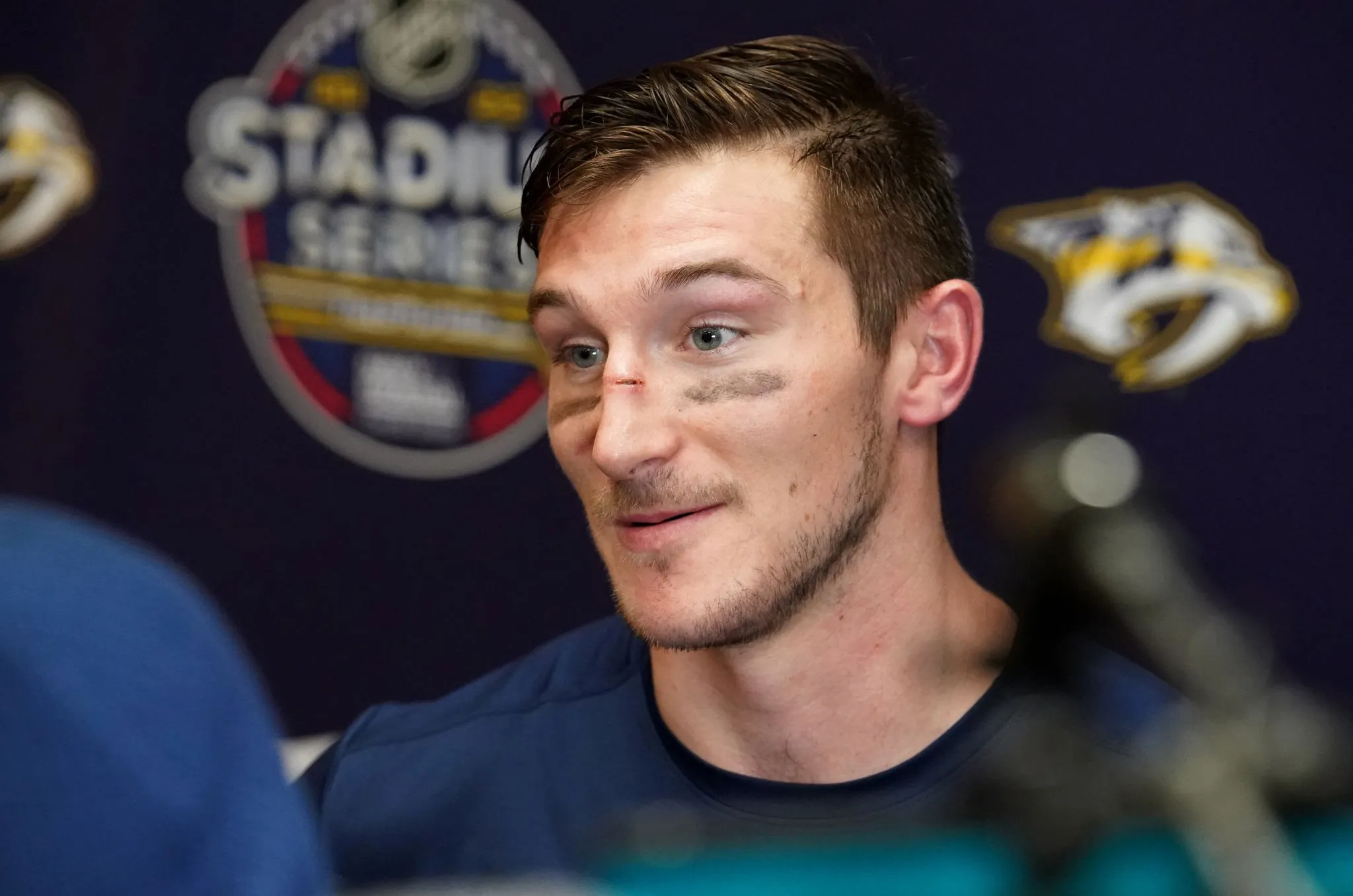 New Bruins Forward’s Contract Named One of the Worst