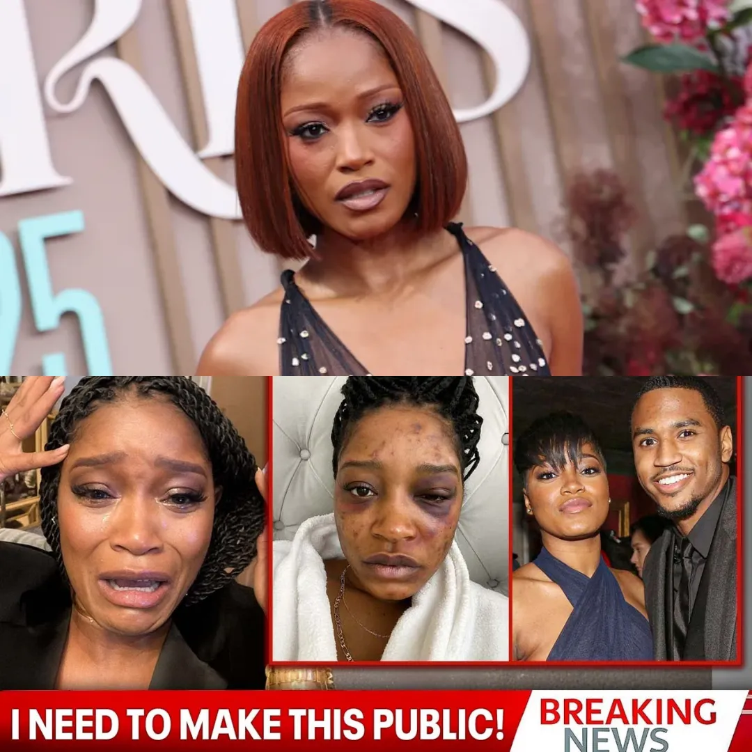 BREAKING NEWS: Keke Palmer Breaks Her Silence About Trey Songz — “They Tried to Bury the Truth”