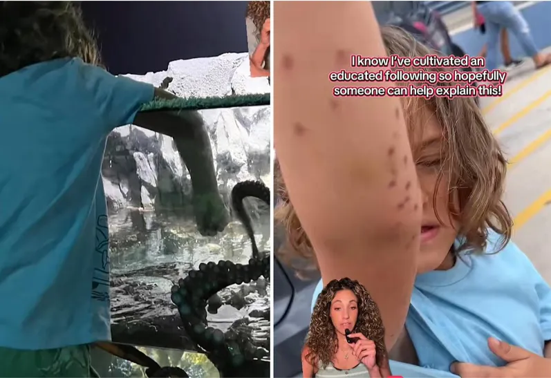 Octopus attacks 6-year-old boy at Texas aquarium, mom claims: ‘We started yelling for help’ Octopus attacks 6-year-old boy at Texas aquarium, mom claims: ‘We started yelling for help’
