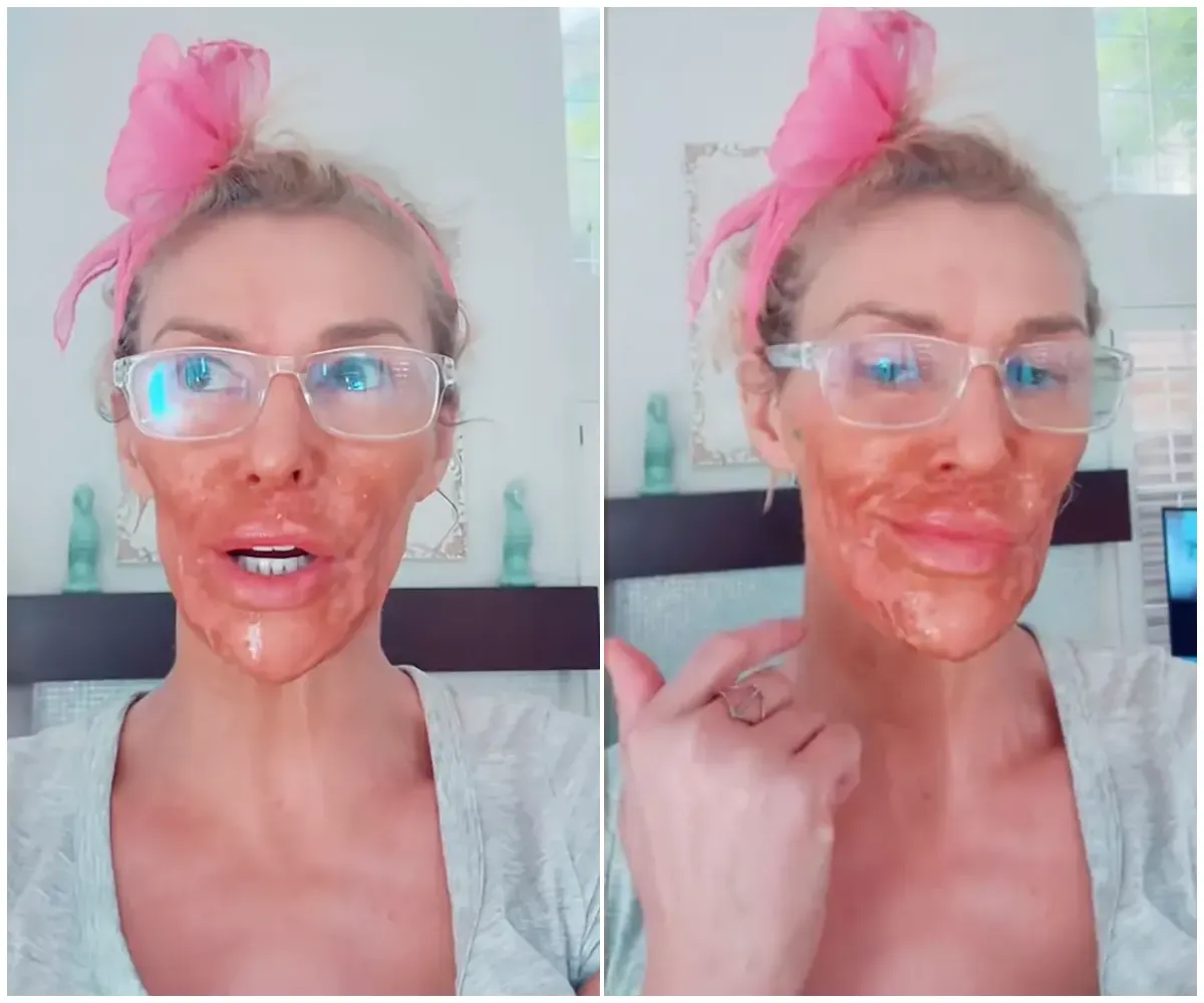 Brandi Glanville names her facial parasite after her ‘Real Housewives’ nemesis - suong